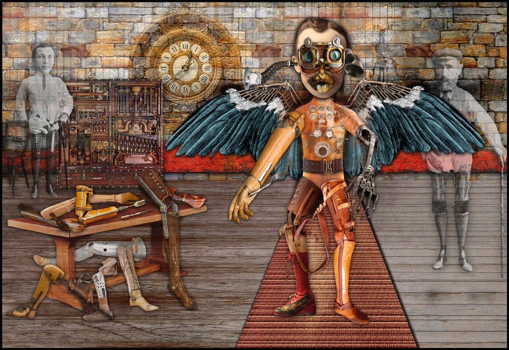 Prosthetic WS
